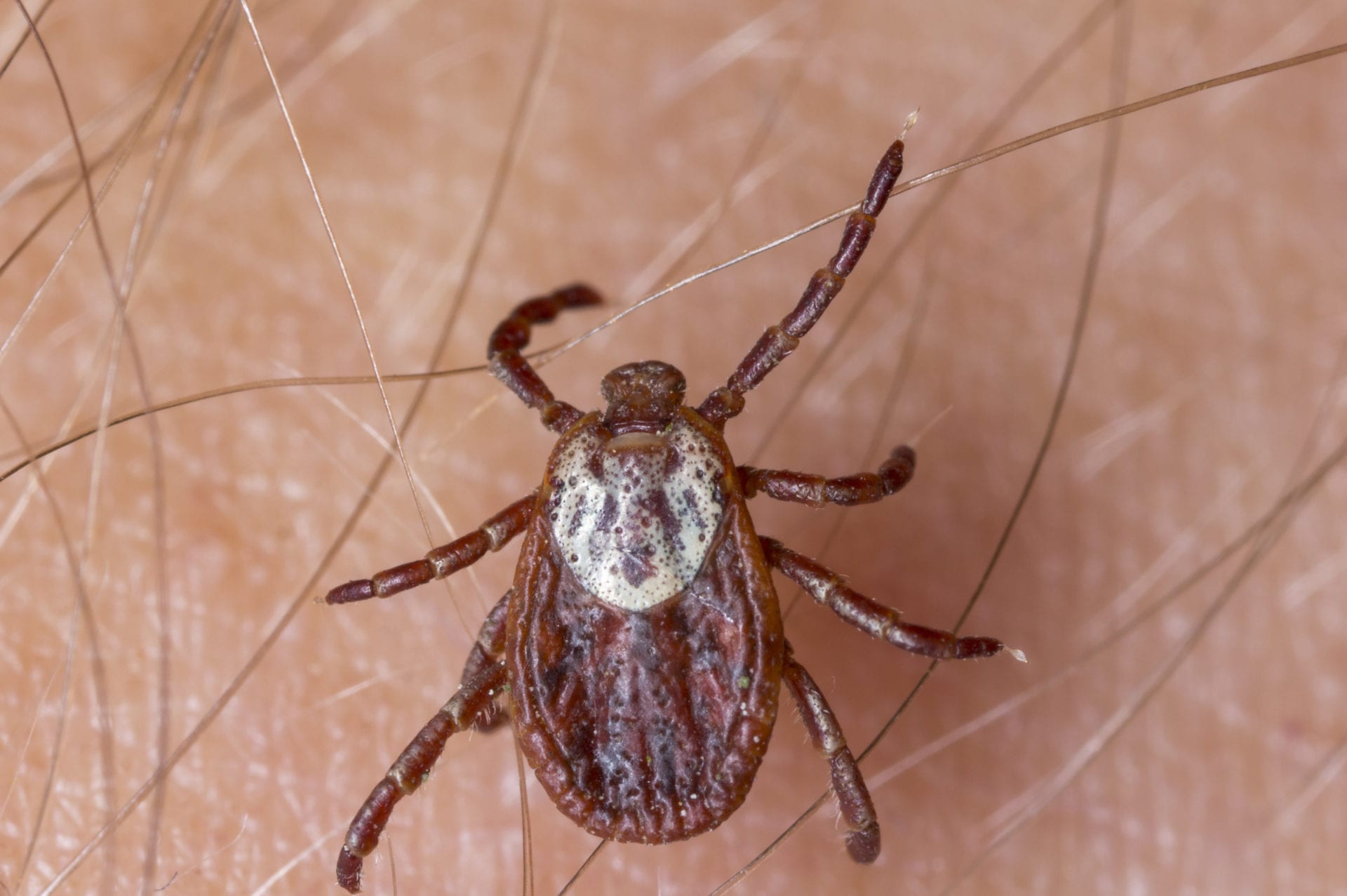 American Dog Tick on a person's skin.
