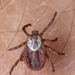 American Dog Tick on a person's skin.